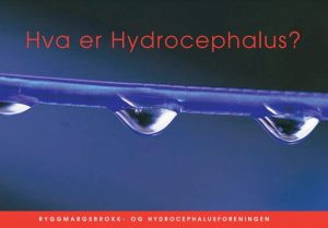 Forsidebilde til brosjyren Hva er Hydrocephalus.